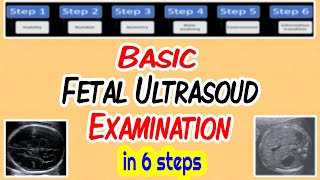 Basic Fetal Ultrasound Examination [upl. by Calley]