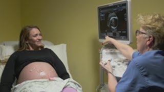 Ultrasounds during pregnancy [upl. by Maril]