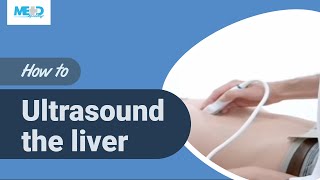 How to ultrasound the liver [upl. by Brook77]