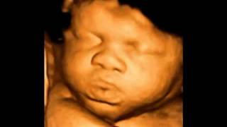 What is 4D ultrasound scan [upl. by Drummond307]