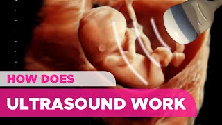 How Does an Ultrasound Works [upl. by Bron]