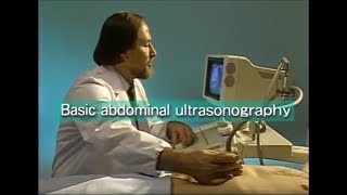 How to do abdominal ultrasound examination [upl. by Golightly49]